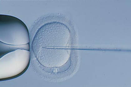 ICSI: Iniezione intracitoplasmatica dello spermatozoo